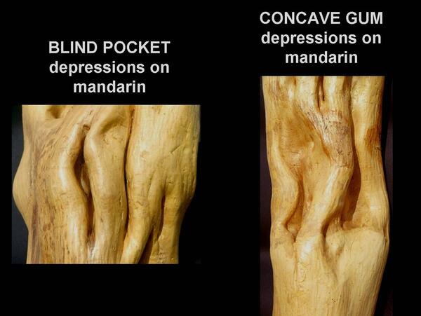 Concave Gum - Blind Pocket 